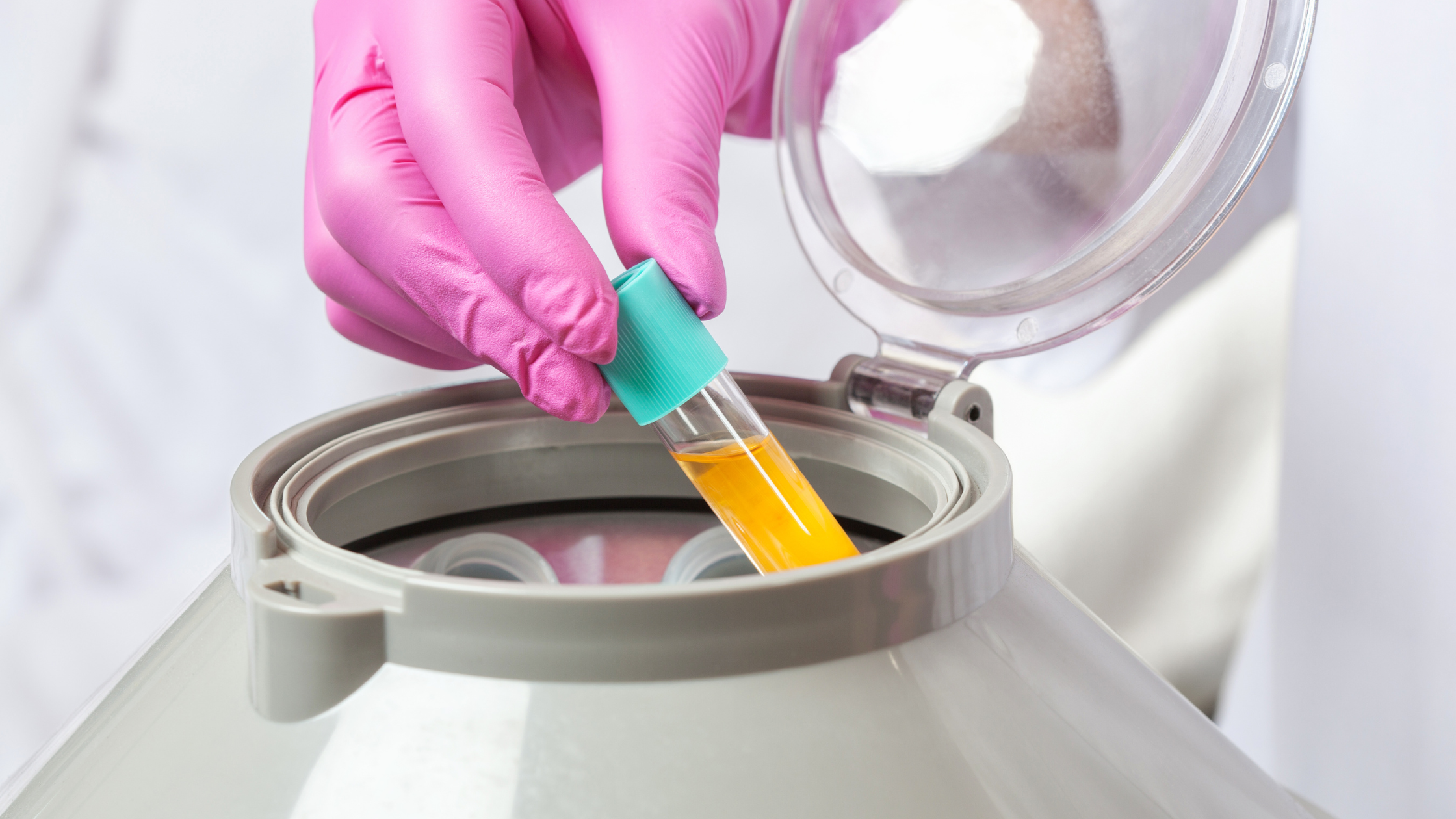 platelet-rich plasma in centrifuge