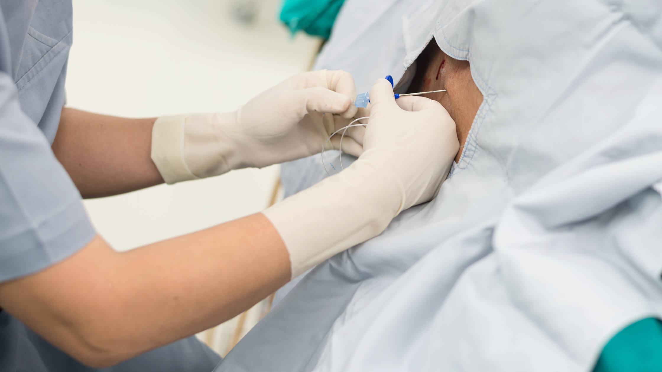epidural steroid injections epidural steroid injections