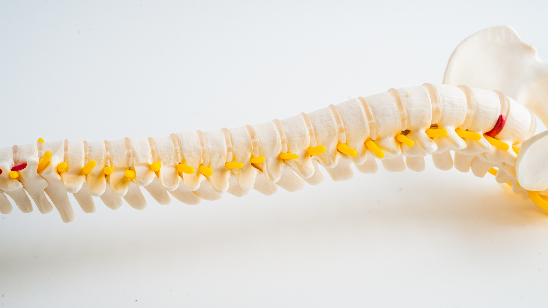 spinal cord stimulation