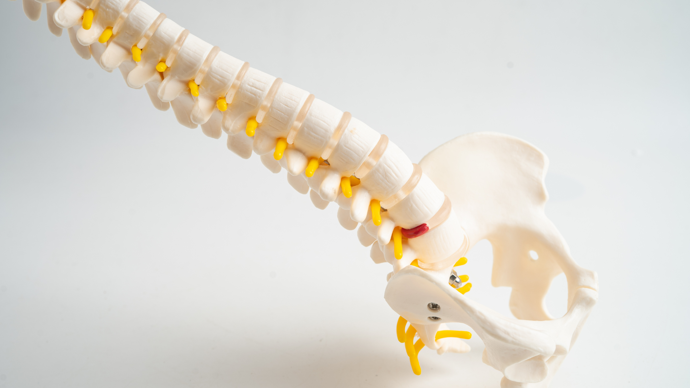 herniated discs