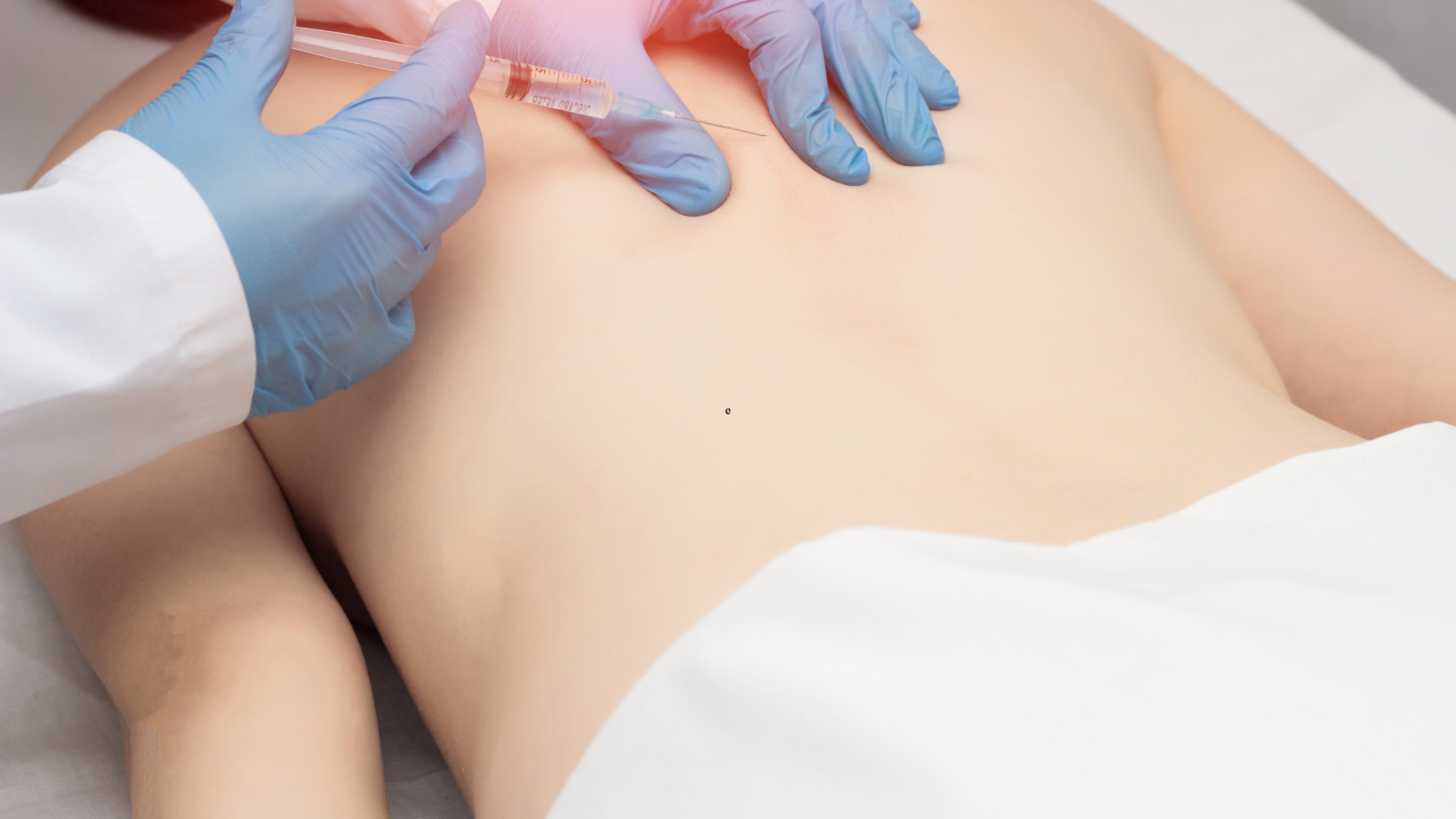 trigger point injections