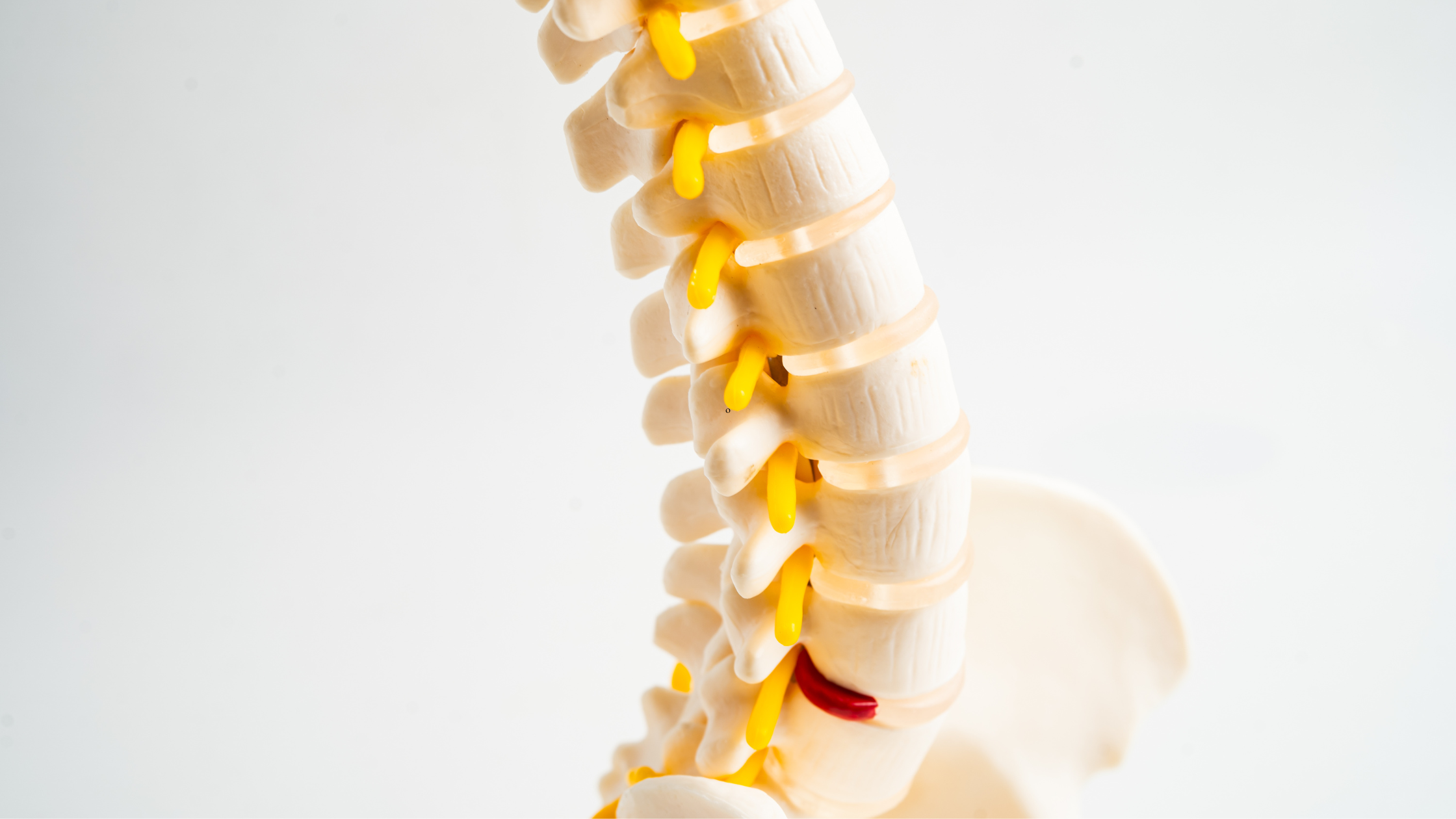 degenerative disc disease
