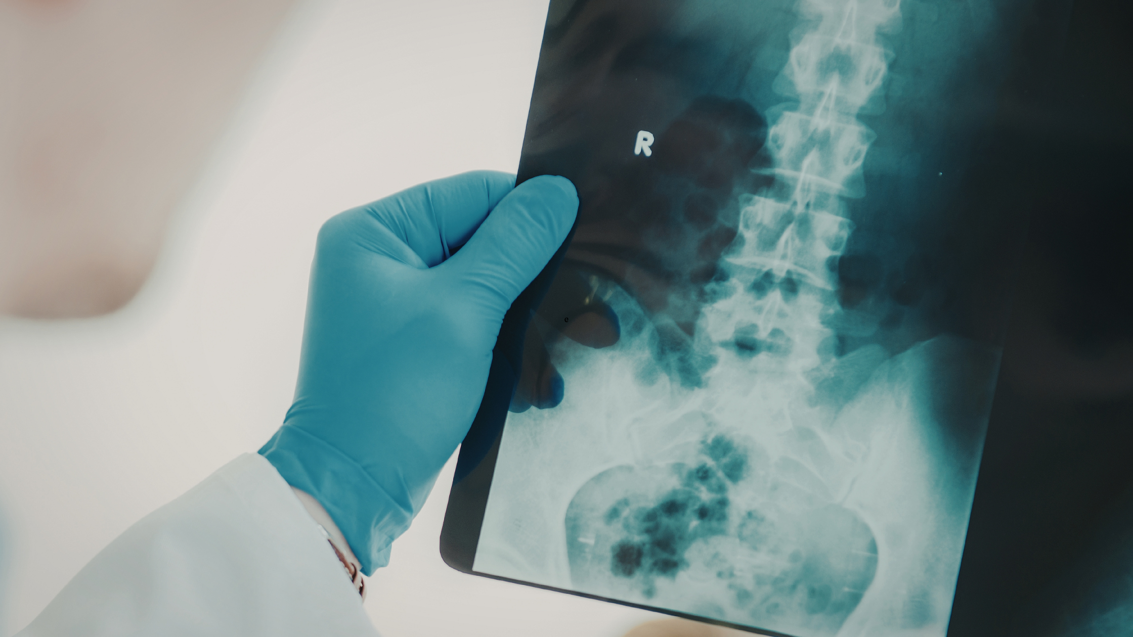 minimally invasive spine treatments