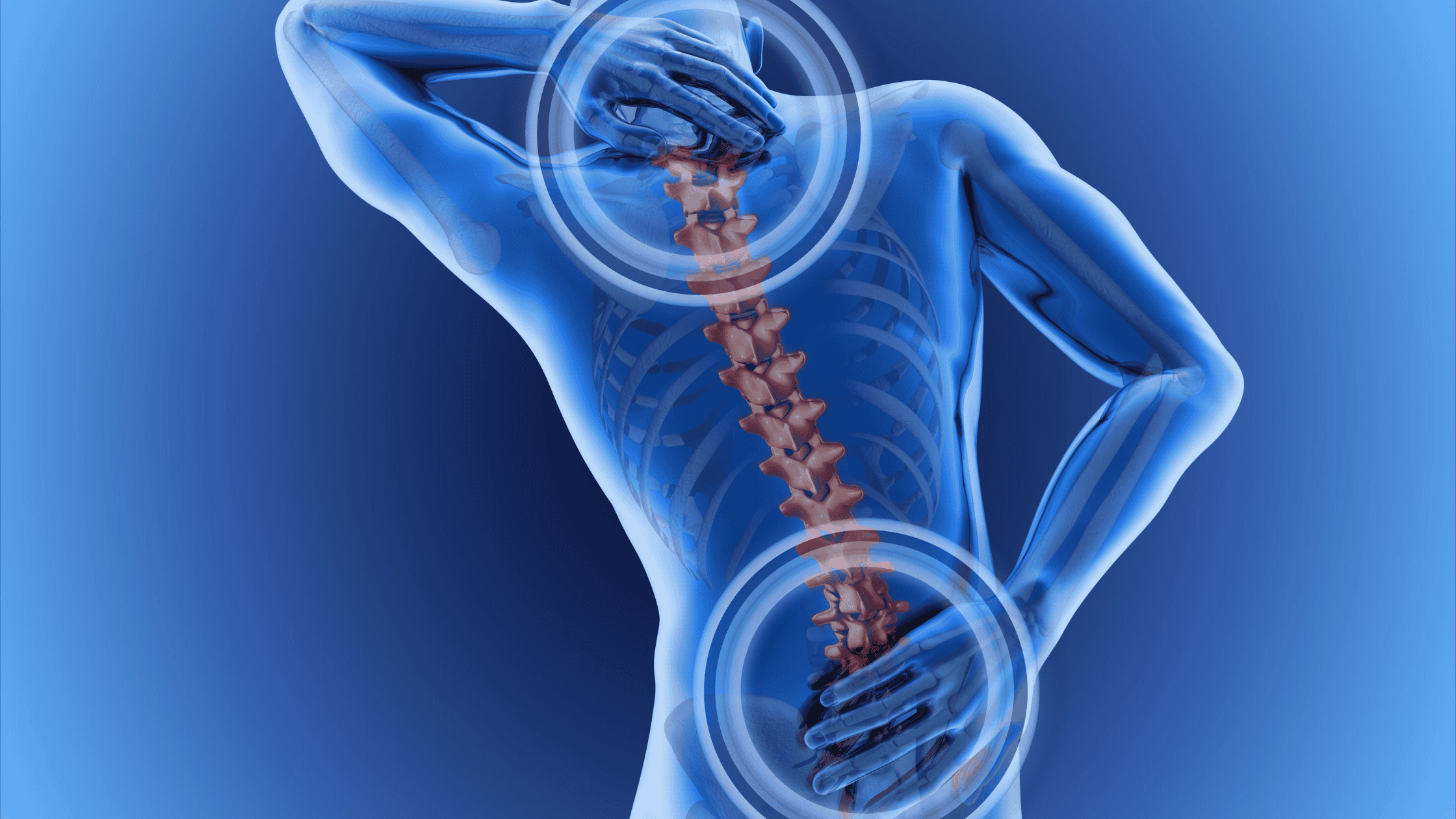 nerve root block